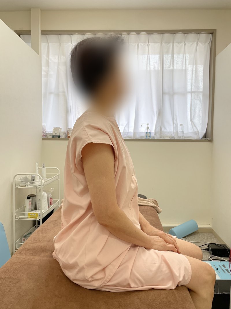 DDS施術後の状態