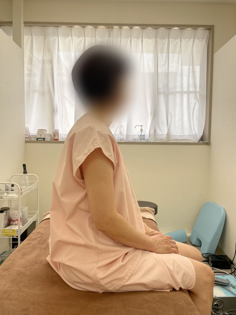 DDS施術前の状態